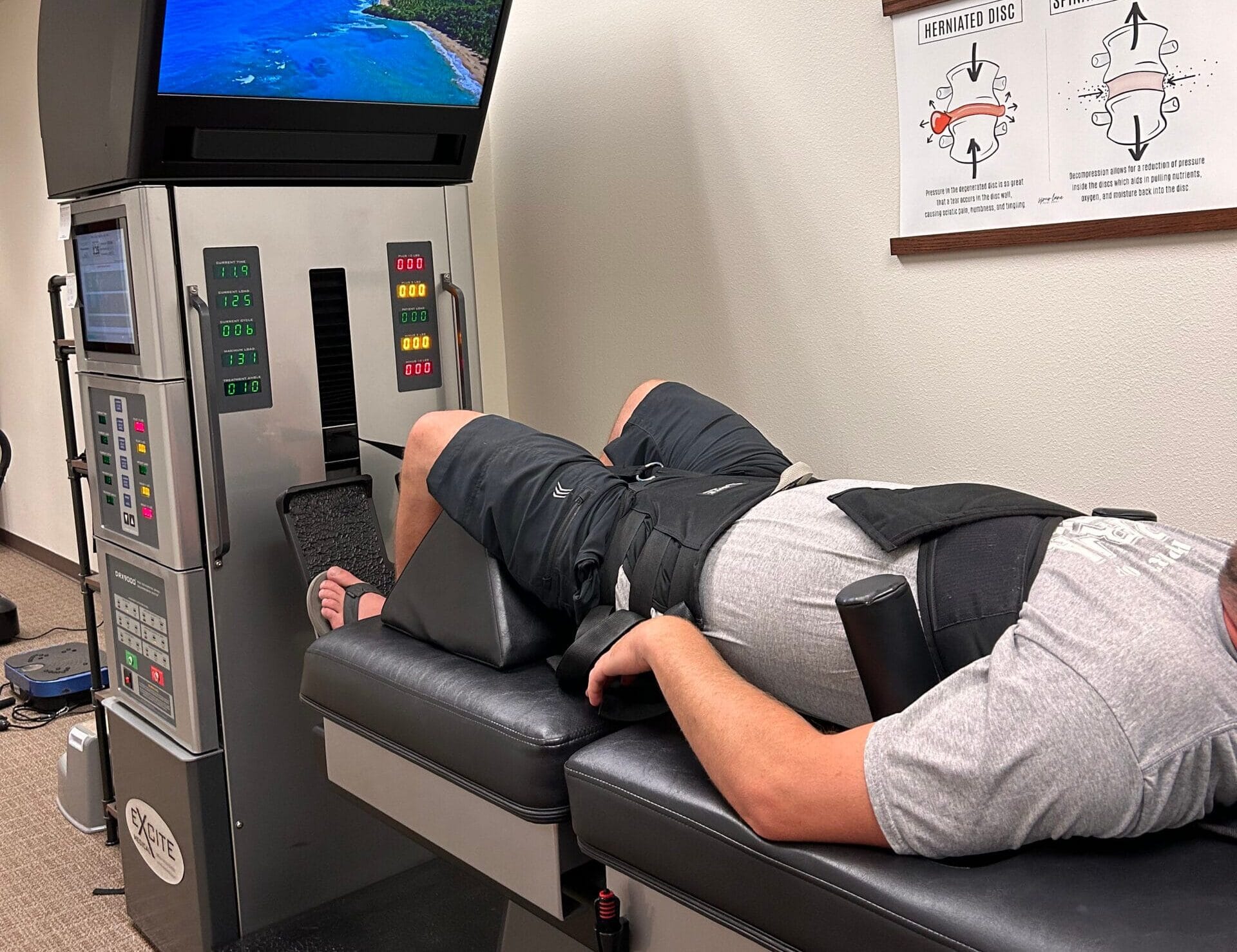 Man getting a spinal decompression - Spinal Decompression in Meridian, ID